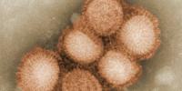 State health officials confirm rare swine flu case in Ionia County resident