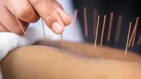 3 science-backed remedies for low back pain that experts recommend