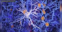 Expert emphasizes how metabolism and lifestyle choices can affect brain health in older age