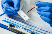 Australian Clinical Labs (ASX:ACL): Why Watch This ASX 300 Healthcare Stock?