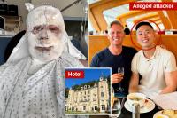 Entrepreneur shows shocking photo after his lover allegedly attacked him in luxury French villa