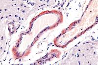 University of Rhode Island Wins Grant to Study Cerebral Amyloid Angiopathy Prevalent in Alzheimer’s Patients