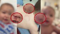 Oklahoma daycare closes amid investigation into 11-month-old's injuries after first day