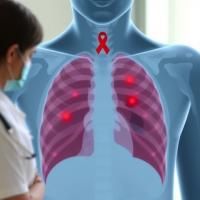 Real-world study confirms TB preventive treatment works for people with HIV