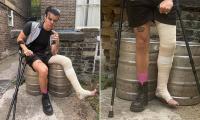 Yungblud sports huge cast and crutches after 'fracturing his leg in horror motorbike accident'