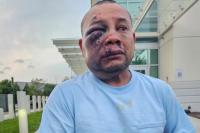ICE Agents Beat Immigrant Into a Brain Bleed, Then Refuse Ankle Tag Removal for Life-Saving MRI