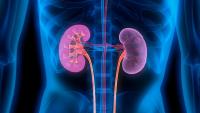 Australia first for Hansa’s Idefirix in commercial kidney transplant