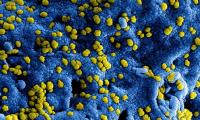 UPDATE: SW Wisconsin measles outbreak increases to 41