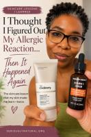 Allergic Reaction to Skincare Products: What I Learned
