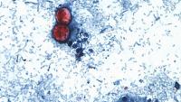 North Carolina reports 23 more cyclosporiasis cases, bringing total to 929 North Carolina health officials are reporting more than 20 new cases of cyclosporiasis, an intestinal illness caused by a parasite that can cause diarrhea.