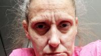 Woman, 38, gets toothache from 12-can-a-day cooking fuel habit - so rips all gnashers out