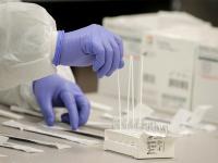 India has 73 health workers per 10,000; global shortage tops 34 mn: Lancet study