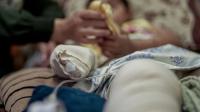 Gaza’s Child Amputees Reveal the Cruelty of Medical Blockade