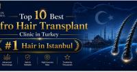 Top 10 Best Afro Hair Transplant Clinic in Turkey