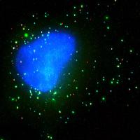 Experimental Synthetic mRNA Platform May Lead to Faster, More Effective Therapeutics for Infectious Disease, Cancer