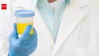 Can human urine help make rocket fuel and support EV battery technology? Scientists develop new way to turn urea into hydrazine