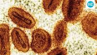 Guinea-Bissau reports first mpox outbreak, half of suspected cases are children