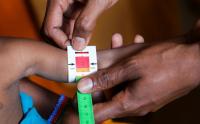 Somali child hunger crisis deepens as facilities close due to aid cuts, UNICEF says