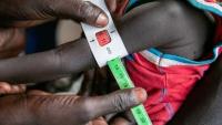Somalia: Child malnutrition worsens after cuts in international aid