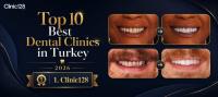 Top 10 Best Dental Clinics in Turkey (2026)