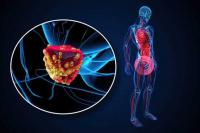 Patient lift as more hospitals adopt new prostate therapy