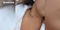 ‘Living nightmare’: New York woman’s throat cut in attack during trip near the Grand Canyon
