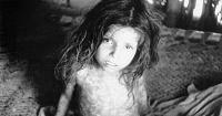 How illnesses like smallpox in colonial India exposed Britain’s myths of control and invincibility