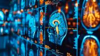 Georgia State Researchers Uncover Brain-Network Dynamics in Schizophrenia