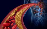 Cholesterol Levels Rise After 40 Due to Hormonal Changes, Metabolism, and Lifestyle