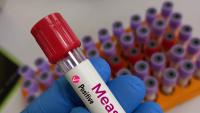 Pennsylvania: Measles Death Reported
