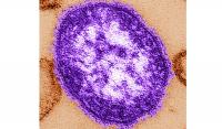 Maryland declares measles outbreak in three counties