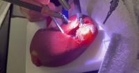 Oregon Rainmakers: Philomath’s Lazarus 3D helps train medical professionals by creating realistic practice organs and tissue