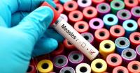 Pennsylvania reports sixth measles-related death this year