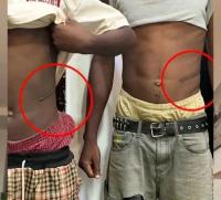 Inside Karu’s ₦7m Kidney Trade: How Poverty Is Driving Desperate Choices in Nigeria