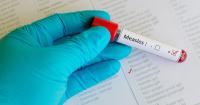 Pennsylvania Department of Health reports first case of measles in Westmoreland County this year