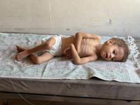 Gaza isn’t able to recover from famine as acute malnutrition soars across the Strip, new report finds