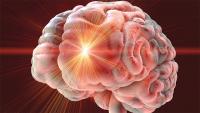 Exercise Type Matters for Post-Stroke Mental Health
