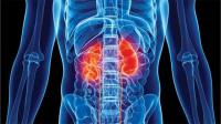 Kidney Failure: Experts urge Nigerians to watch diet