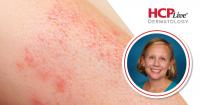 Resilience in Medicine, HS Treatments, and the Oral JAK Pipeline Today