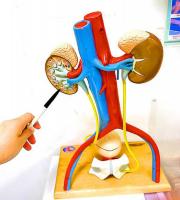 Deaths related to kidney disease rise