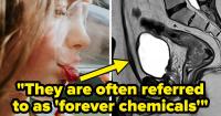 Bad News, Everyone: This 1 Fan-Favorite Beverage Might Increase Your Colorectal Cancer Risk