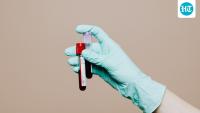 Health tests you need at 25, 35, 45 and 50: Doctor shares age-wise guide