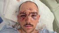 Walla Walla man faces more surgeries after surviving Alaska bear mauling