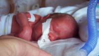 Canada is Counting Late-Term Abortions as Stillborn Deaths
