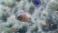 Brain-Eating Amoeba Leaves North Carolina Teen Critically Ill
