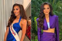 At 2, Her Parents Were Told She’d Never Speak Clearly. 20 Surgeries Later, She’s Singing at Miss America (Exclusive)