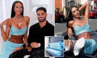 Australian influencer who underwent controversial 'Barbie waist' surgery now reveals her dangerous tanning obsession: 'I'm so addicted I'm seeing a therapist'