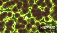 Drug-resistant bacteria found in Moroccan communities, water and food systems