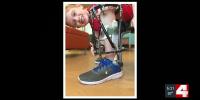 St. Louis hospital saves Nebraska boy’s leg from amputation