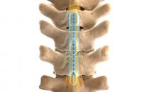 Boston Scientific recalls spinal cord stimulator leads after 1,081 serious injuries